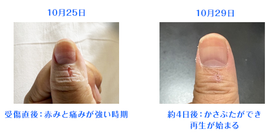 意思の強さと鍼灸