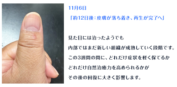 意思の強さと鍼灸