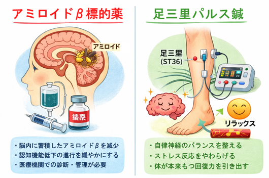 新薬（アミロイドβターゲット薬）と足三里パルス（鍼灸）の比較